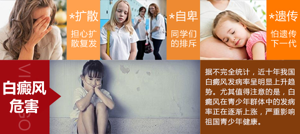 白癜风引起的并发症